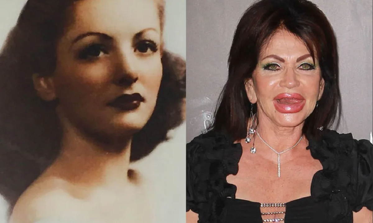  Многие звезды идут на риск, чтобы сохранить и приумножить молодость. Но не учитывают, что «передоз» красоты выглядит порой очень комично, или даже страшно.-3