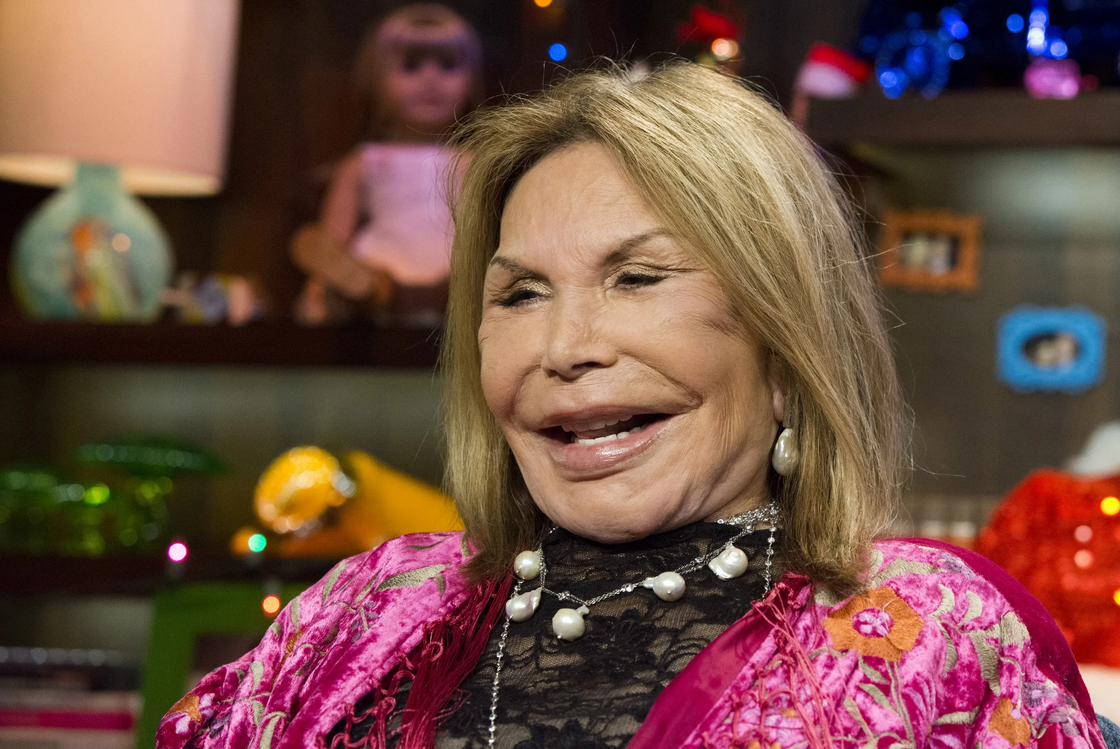  Многие звезды идут на риск, чтобы сохранить и приумножить молодость. Но не учитывают, что «передоз» красоты выглядит порой очень комично, или даже страшно.-9