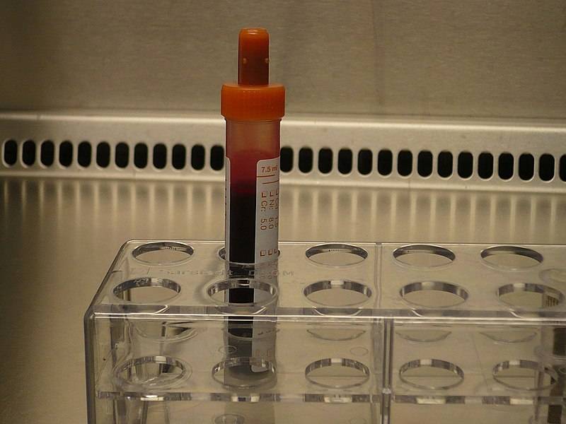 Мировой спорт под американским игом. Последствия «акта Родченкова» Мировой спорт под американским игом. Последствия «акта Родченкова» геополитика,россия