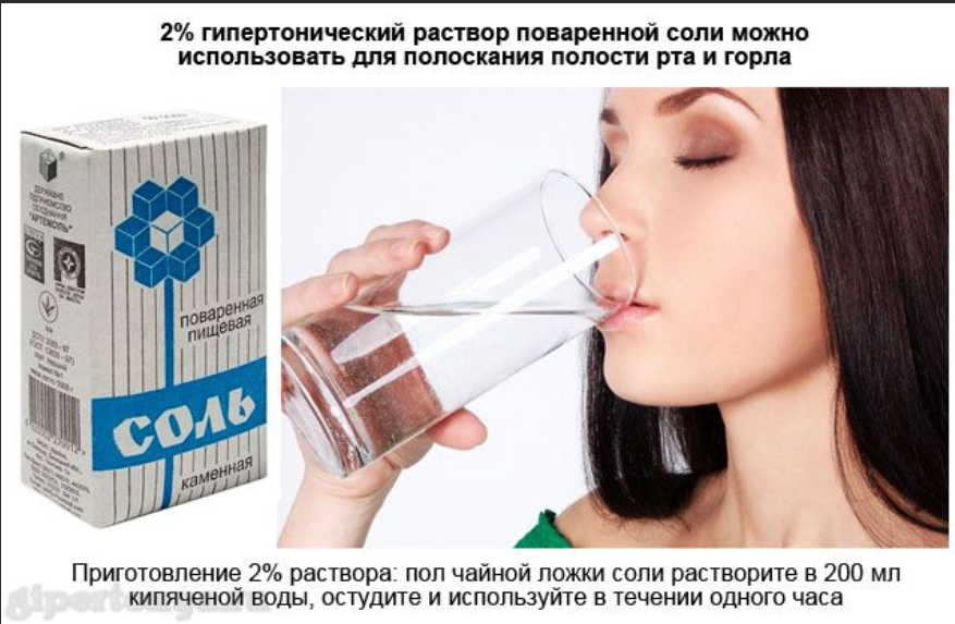 Гипертонический раствор для лечения: от инсульта, головной боли, варикоза и 50+ заболеваний