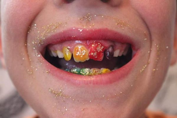 Новшество «Rainbow Teeth»: вы будете светиться улыбкой от осознания, насколько уже похудели!