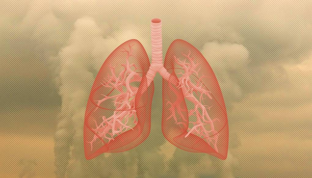 Возьмите под контроль воздух, которым вы дышите воздух, очередь, сгорания, смертей, уголь, частицы, первую, слабость, должны, головная, загрязнен, предприятия, стороны, дыхания, зрительного, воздуха, восприятия, заводы, пульса, радиация