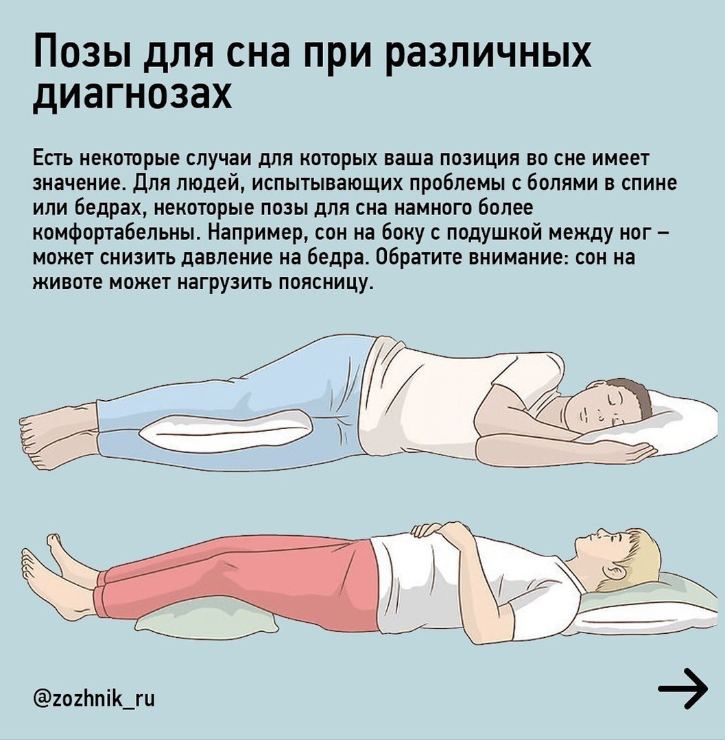 Лежа на боку кружится голова. Правильная поза для сна. Правильное положение для сна. Полезные позы для сна. Неправильные позы для сна.