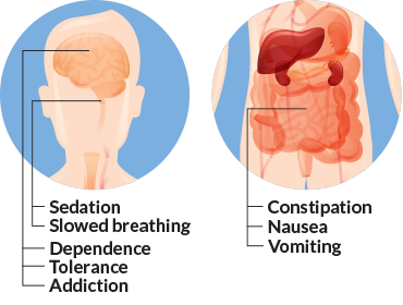 opioid side effects in the brain and gut
