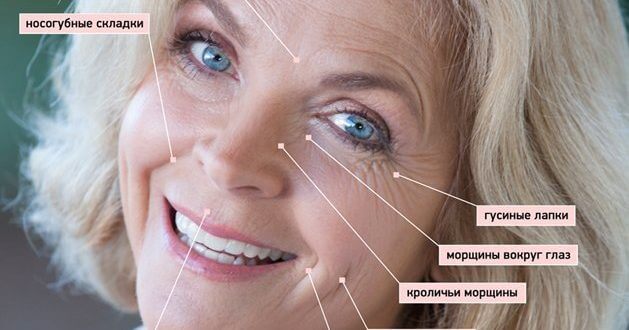 Как выглядят морщины на лице