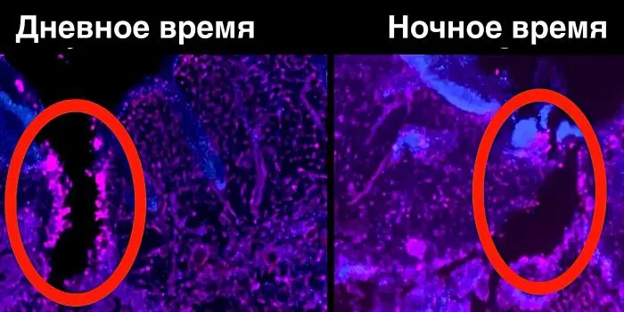 Почему раны, полученные днем, заживают быстрее ночных быстрее, человек, разница, заживают, заживали, заживлении, ритмы, человека, людей, травм, система, ожоги, среднем, Кембриджского, момент, Ученые, ночью, суток, лучше, повреждения