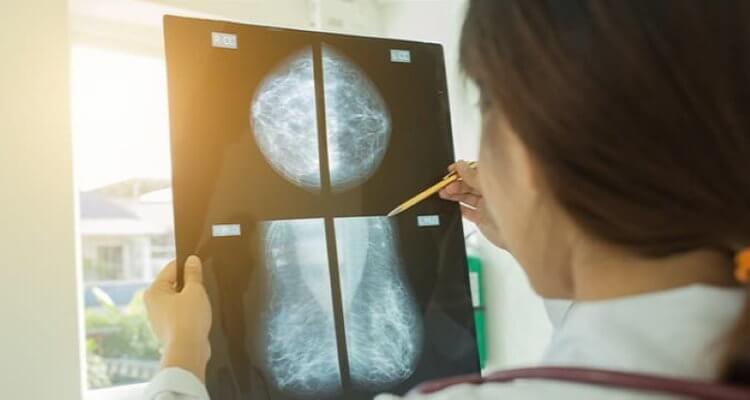 Искусственный интеллект распознает рак груди лучше, чем профессиональные доктора искусственный, интеллект, Великобритании, женщин, груди, молочных, снимков, рентгеновских, помощи, крайне, заболевания, смертельный, пациенток, Однако, результаты, ошибки, рентгенологами, диагноз, точность, доктора
