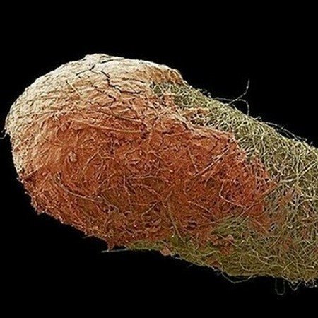 Красота внутри: микробиолог из Уфы показывает в инстаграме вирусы и бактерии, которые живут в нас вирус, микробиолог, микроорганизм