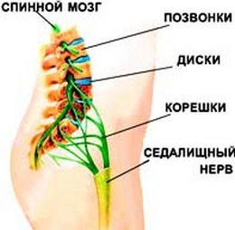 Если болит поясница позвоночника, может, диска, поясничного, мышцы, также, отдела, корешки, межпозвонкового, нервные, обычно, больных, могут, радикулита, спине, позвонков, чтобы, только, очень, люмбаго