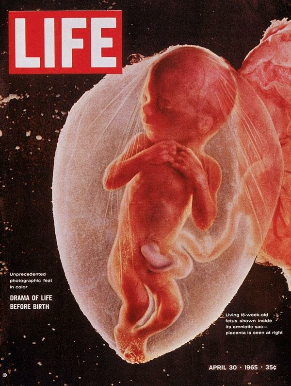 Обложки журнала «Life», навсегда вошедшие в историю