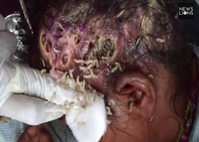 В Индии нашли бездомную с изъеденной червями головой