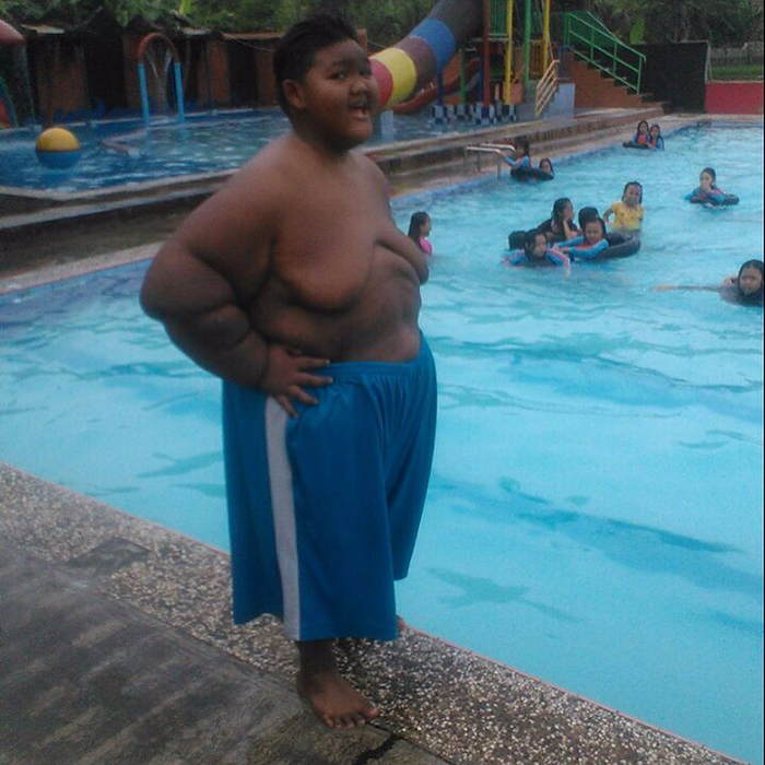 Самый толстый мальчик в мире похудел на 80 килограммов