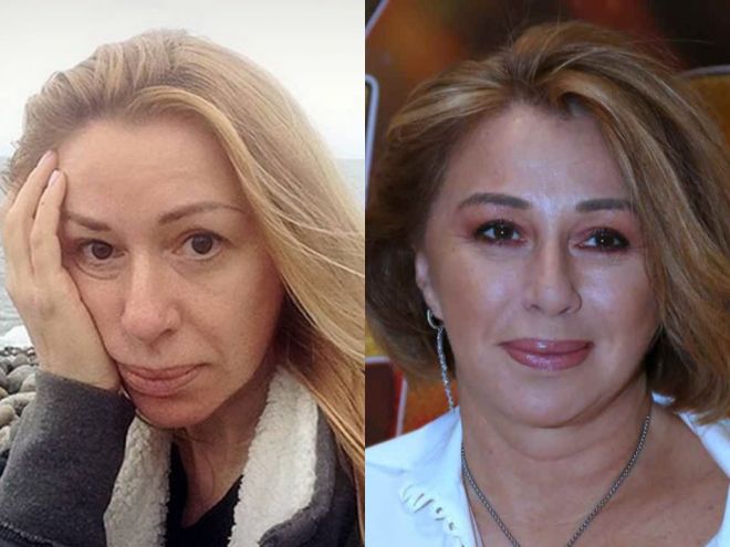 Алена апина пластика фото