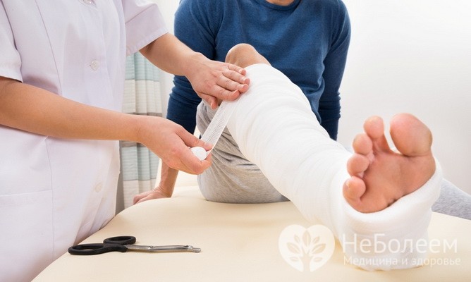  Травмы – одна из причин отечности ног 