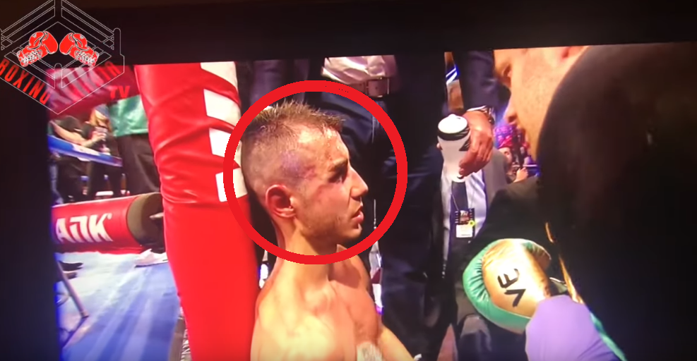 Боксер после удара в затылок. Последний бой Максима Дадашева.