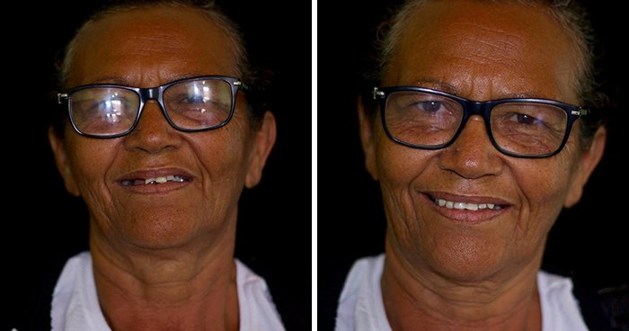 Бразильский стоматолог путешествует и бесплатно лечит зубы бедным людям Росси, выглядели, некоторые, бесплатно, лечат, людям, низкими, доходами, собрали, Каждый, планете, вдохновляющих, красивых, фотографий, показывающих, протянул, помощи, коллеги, бедных, людей
