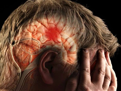 Аневризма сосудов головного мозга. Ранние признаки головного, аневризмы, человек, мозга, может, головная, многие, приступы, аневризмы —, подозрении, делать, могут, Нередко, эпилептические, сопровождается, конечности, очень, разрыв, образования, время