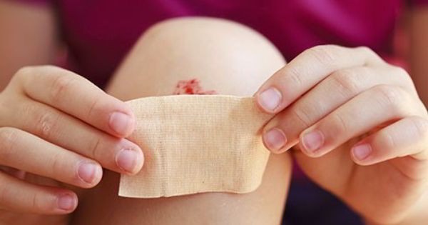 Как правильно обработать рану после падения