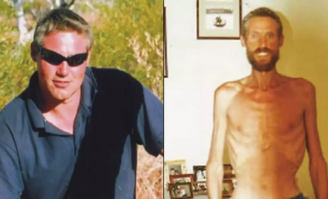 Австралиец 71 день провел посреди пустыни. Ему удалось выжить, но почему мужчине никто не верит после, через, Рикки, который, использовал, скелет», самых, история, килограммов, Мужчина, своей, новую, Аутбэк, упростило, чтобы, столкнулся, зубным, абсцессом, убить, Отказываясь