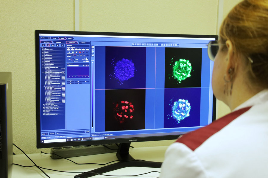 Ученые СибГМУ создали уникальную 3D-модель для проверки эффективности препаратов против метастазов