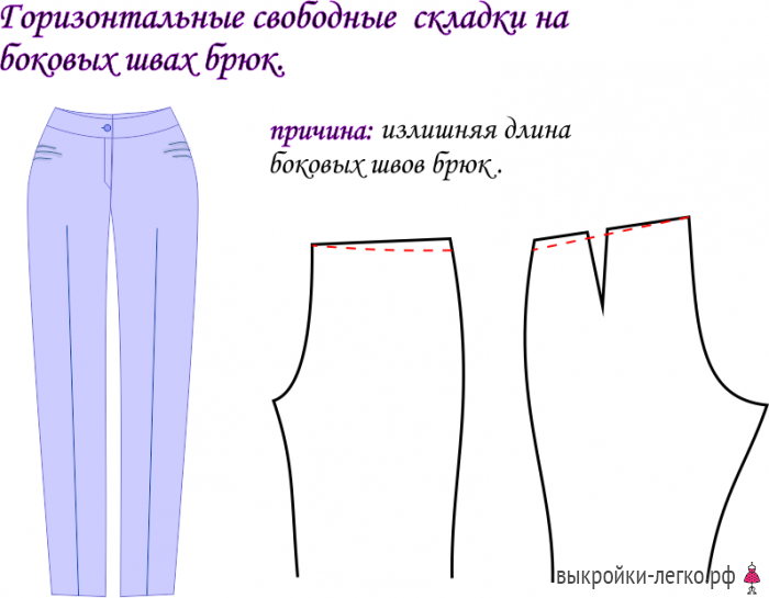 Безценные записи и секреты: устранение дефектов посадки брюк брюки