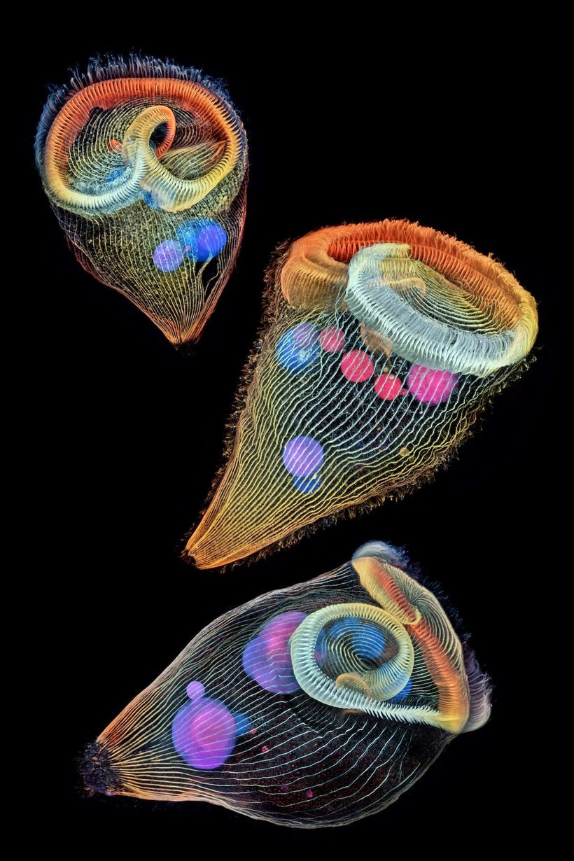 Лучшие работы с конкурса Nikon Small World Photomicrography