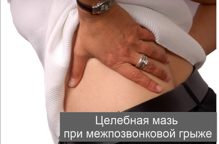 2749438_Celebnaya_maz_pri_mejpozvonkovoi_grije (700x459, 313Kb)