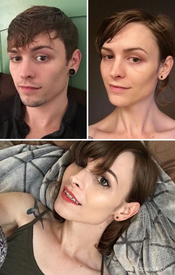 Транс измена муж. ФТМ Джейми 18 +. Трансгеймер до и после операции. Смена пола.