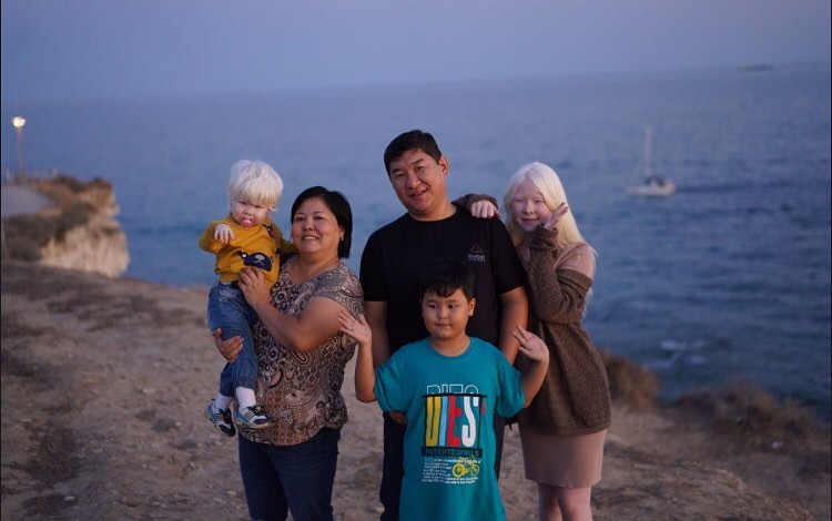 14 малышей, которым досталась очень необычная внешность 