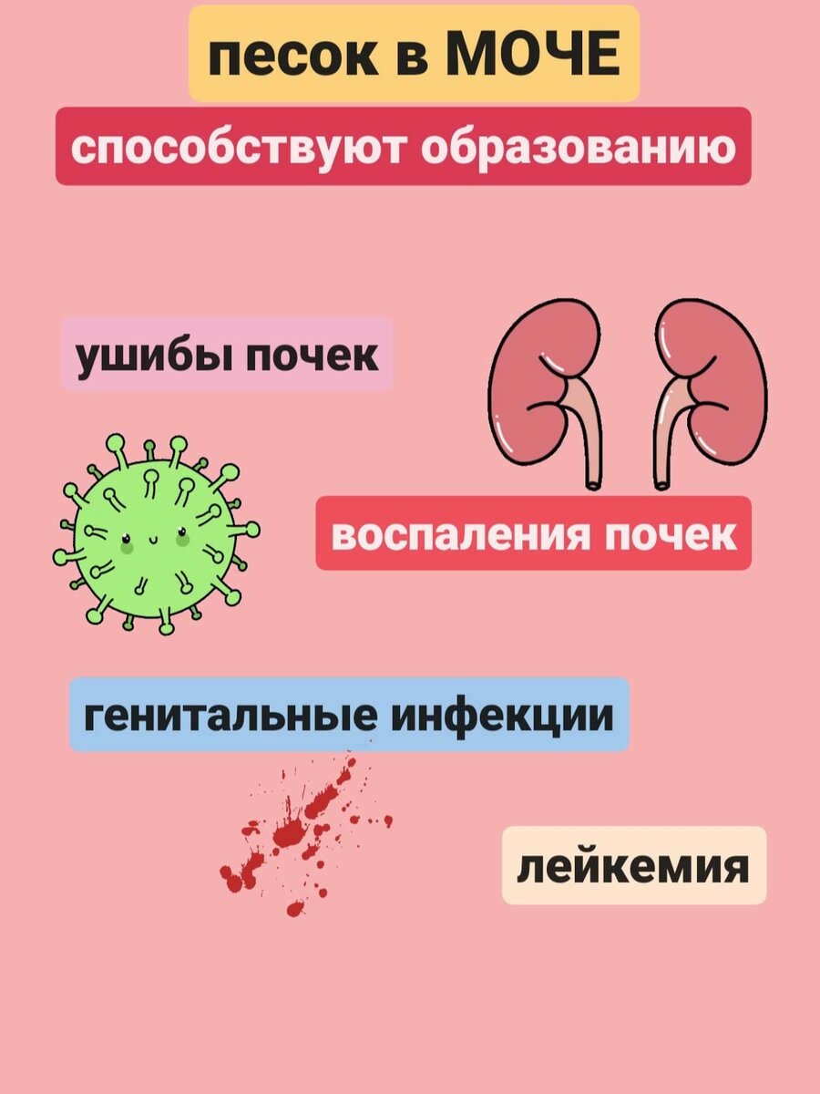 Незаметен и тем опасен. Песок в моче совершенно, обнаруживают, баночку, оставьте, несколько, часовЕсли, увидите, осадок, скорее, всего, песочекМожно, заподозрить, наличие, симптомов, этого, надовсего, навсего, контролировать, физиологические, Пописайте