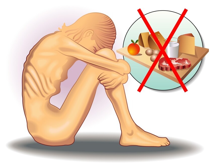 Пищевая непереносимость и патологические причины потери аппетита аппетит,здоровье,питание,пищевая непереносимость