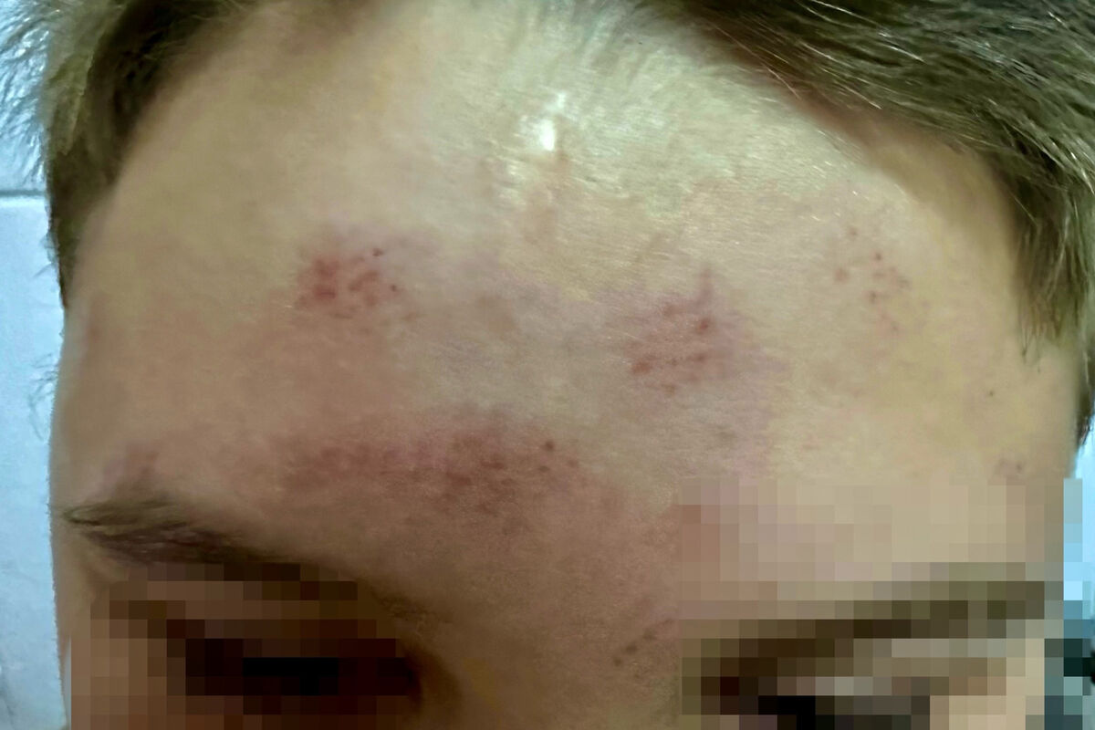 В Пермском крае группа подростков избила школьника ногами по голове