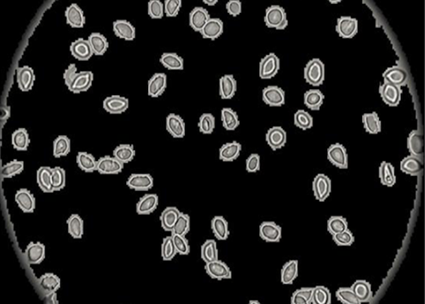 Xu et al. Konvolyutsion Neyron tarmog’i. PLOS Computational Biology.