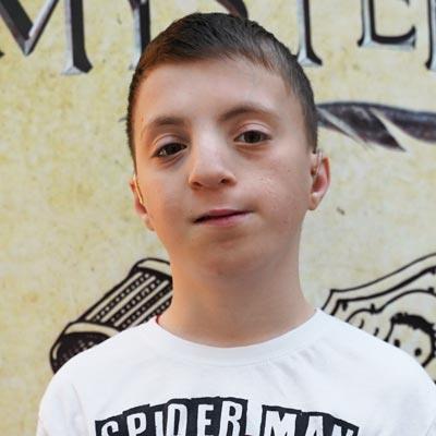 Лева Гордиенко, 10 лет, изолированная расщелина нёба, недоразвитие челюстей, требуется ортодонтическое лечение, 169 540 ₽