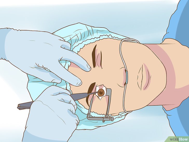 Как избавиться от мушек в глазу: 9 шагов глаза,здоровье,зрение,офтальмология