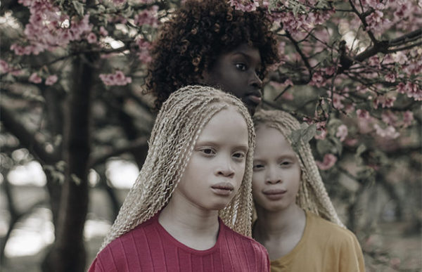 Близнецы-альбиносы покорили модную индустрию