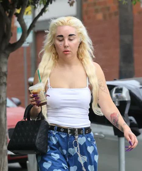 В сети появились снимки сильно похудевшей Аманды Байнс после приёма 