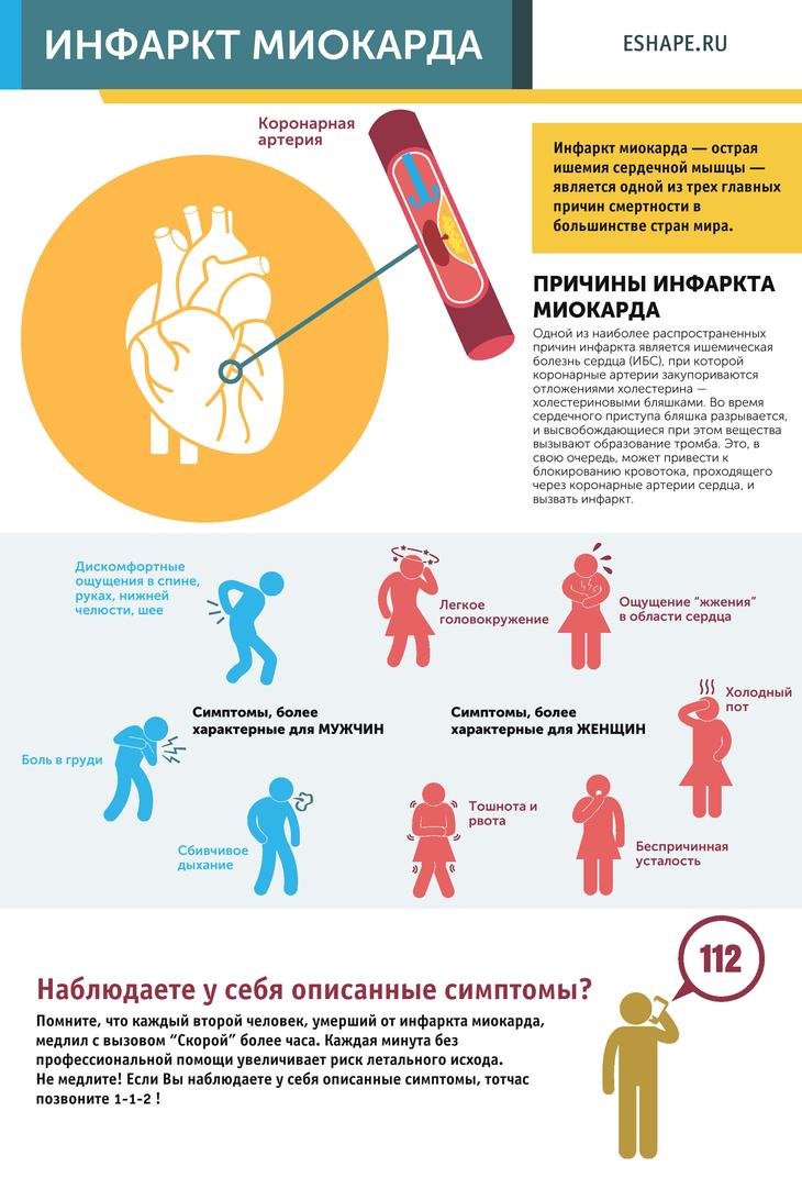 Симптомы инфаркта миокарда