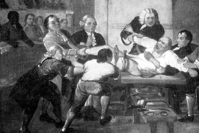 ÐÐ°ÑÑÐ¸Ð½ÐºÐ¸ Ð¿Ð¾ Ð·Ð°Ð¿ÑÐ¾ÑÑ surgery in the 1700s