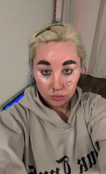 В сети появились снимки сильно похудевшей Аманды Байнс после приёма 