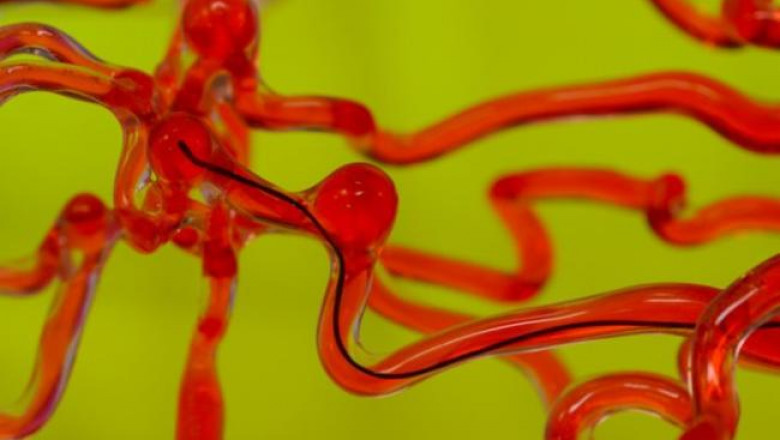 Инженеры из США создали робота-змея, способного проникать в мозг.