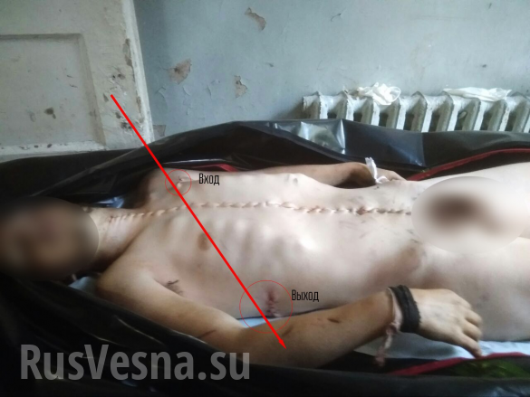 Украина передала ДНР тело бывшего ополченца, убитого СБУ после пыток (ФОТО 18+) | Русская весна