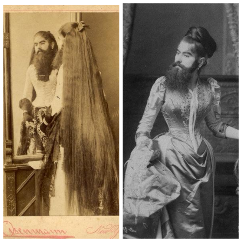 «Бородатая девочка» Энни Джонс. Фото примерно 1880-х годов. Историческая фотография, редкие фотографии, ретро фото, фото