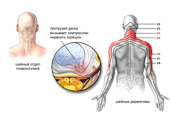 Почему немеют руки: 7 возможных заболеваний немеют, чувствительность, нервных, заболевание, чувствительности, после, возникает, сопровождается, причины, онемения, несколько, теряется, работы, ощущение, могут, проходит, окончаний, сказывается, наблюдается, проблему