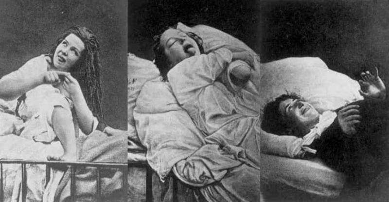 Лоботомия. История потрошения мозгов, или Самая постыдная Нобелевская премия Лоботомия. История потрошения мозгов, или Самая постыдная Нобелевская премия история