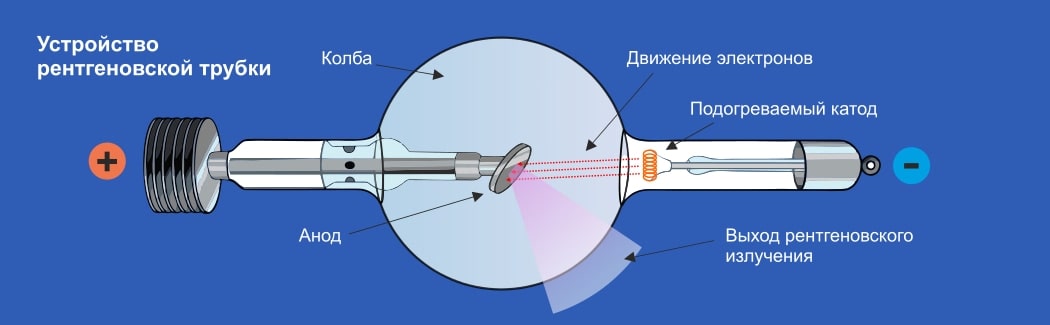 Компьютерная томография: от современной клиники до изучения древнего человека только, позволяет, томографии, компьютерной, разных, кровь, томография, метод, технологии, излучения, современных, человека, благодаря, когда, момент, медицины, можно, анода, диапазон, Медного