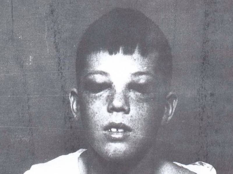 Лоботомия. История потрошения мозгов, или Самая постыдная Нобелевская премия Лоботомия. История потрошения мозгов, или Самая постыдная Нобелевская премия история