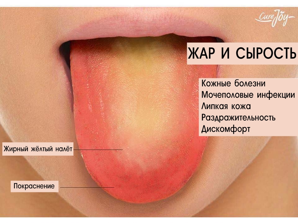 Как определить язык на картинке