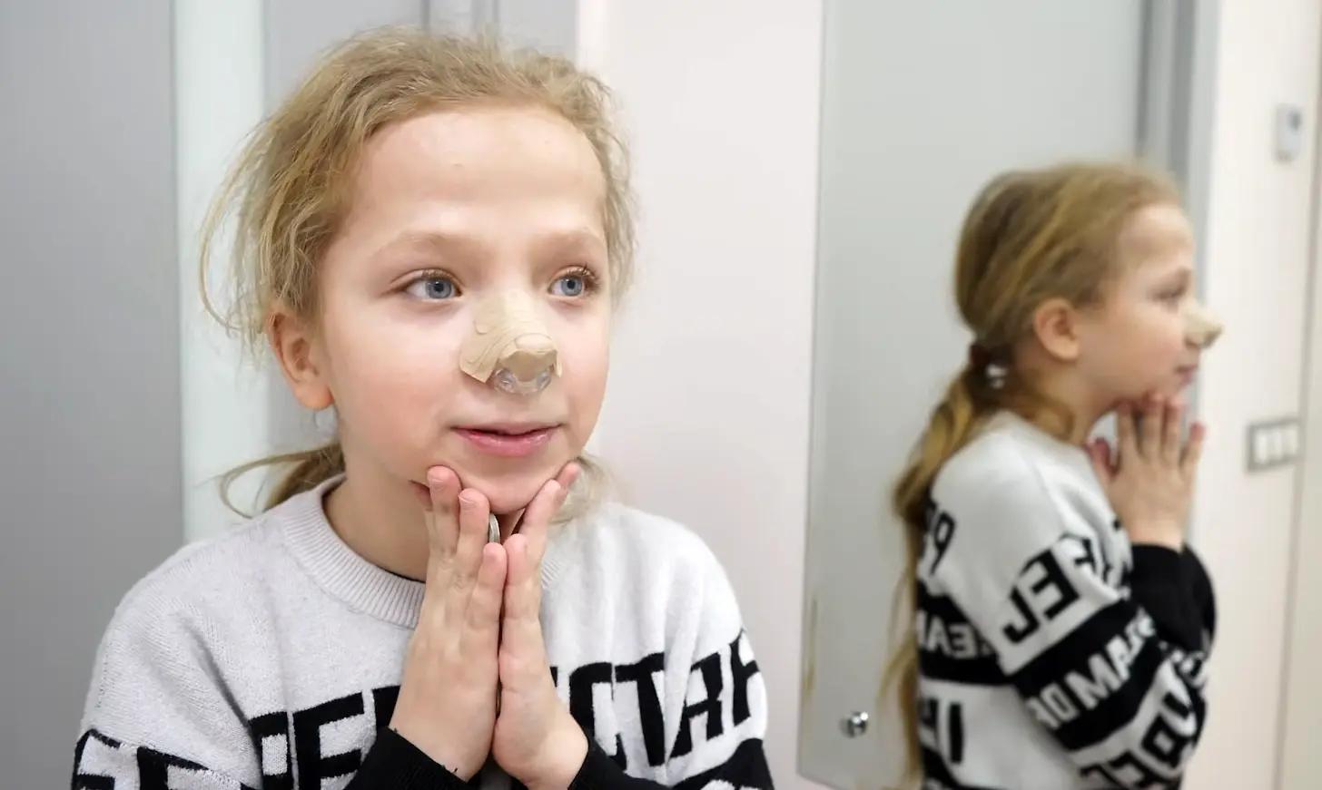 Девочку Варю, которой в 10 лет прооперировали нос, хотят забрать в детский дом детей, Анастасия, Сергей, после, Лукьянов, опеки, состоянии, операции, часто, чтобы, момент, женщина, старших, может, органы, постоянно, нужно, девочка, органов, блогер