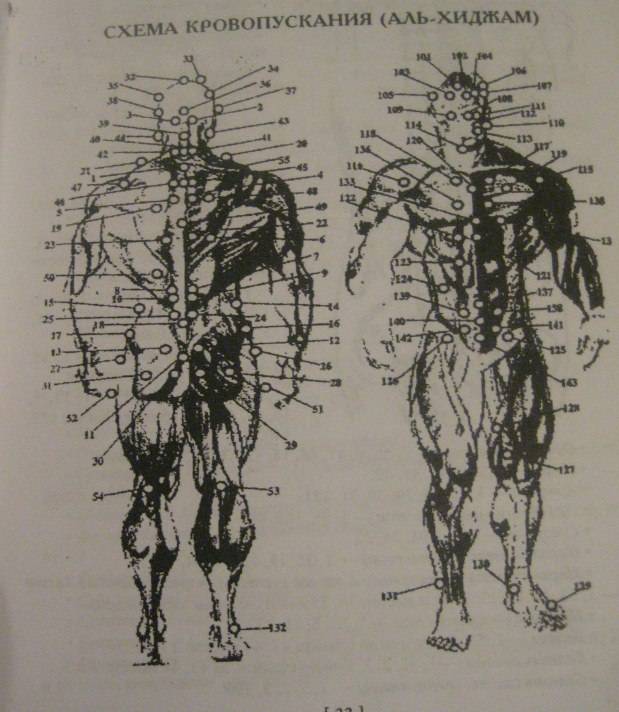 Смертоносные ланцеты врачей и цирюльников Смертоносные ланцеты врачей и цирюльников история